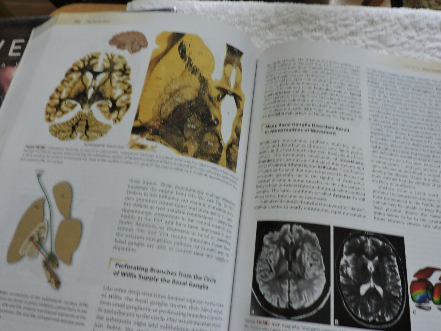 THE HUMAN BRAIN AN INTRODUCTION TO ITS FUNCTIONAL ANATOMY 2009 JOHN NOLTE